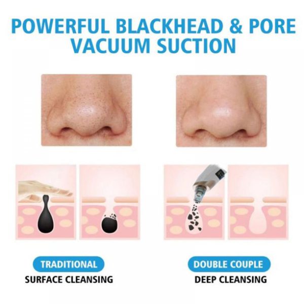 Electric Suction Blackhead And Pore Cleaning - MMLSTORE - Shop The Top Product & Fill Your Cart