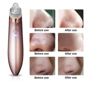 Blackhead Remover Face Acne Black Dot Pimple Electric Blackhead Vacuum Cleaner Pore Skin Care Tool Machine 4 Replacement Head