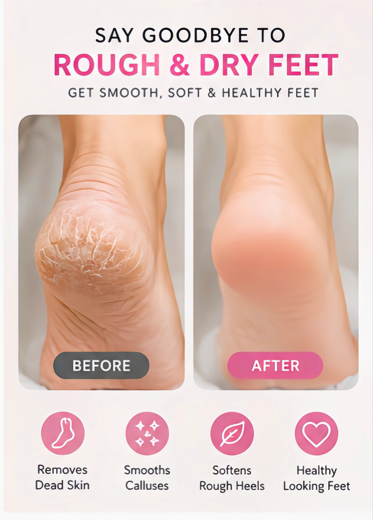Flawless Pedi™ | Rechargeable Electric Foot Callus Remover